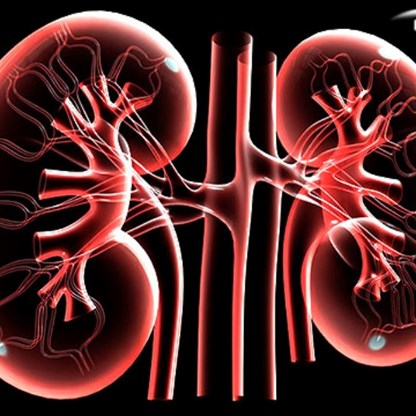 Kidney disease can be prevented in several ways